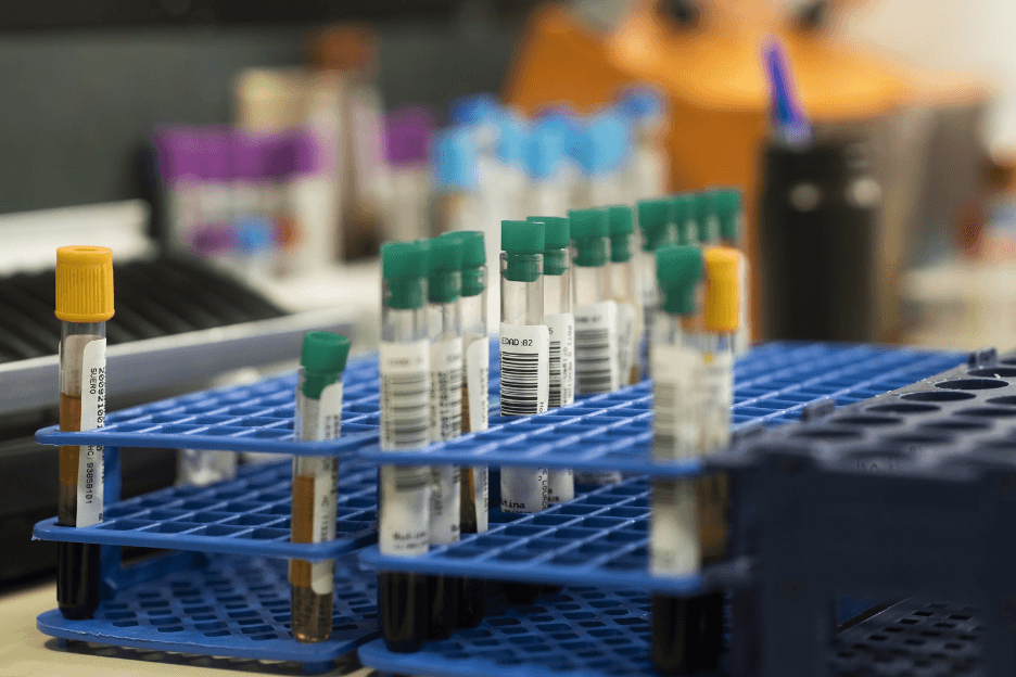 ELISA Tests