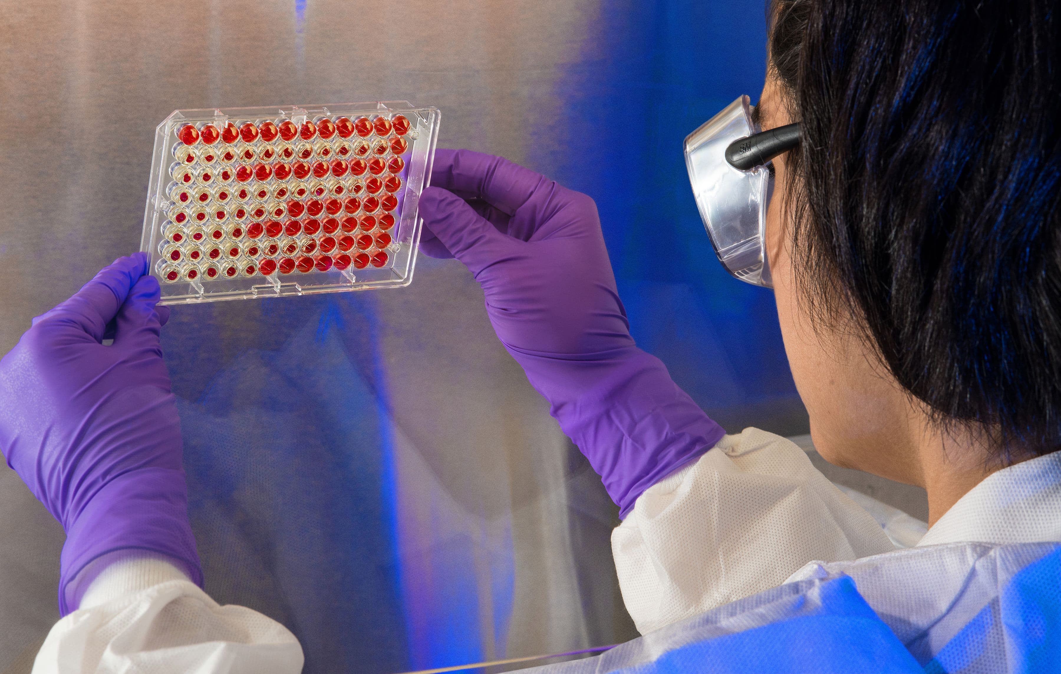Factors for Choosing an ELISA Kit