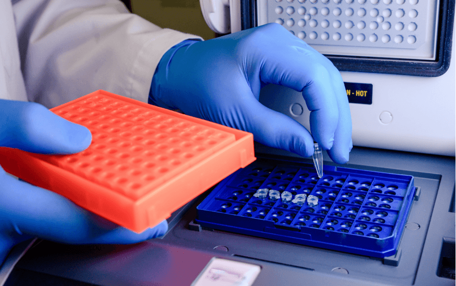 ELISA protocol