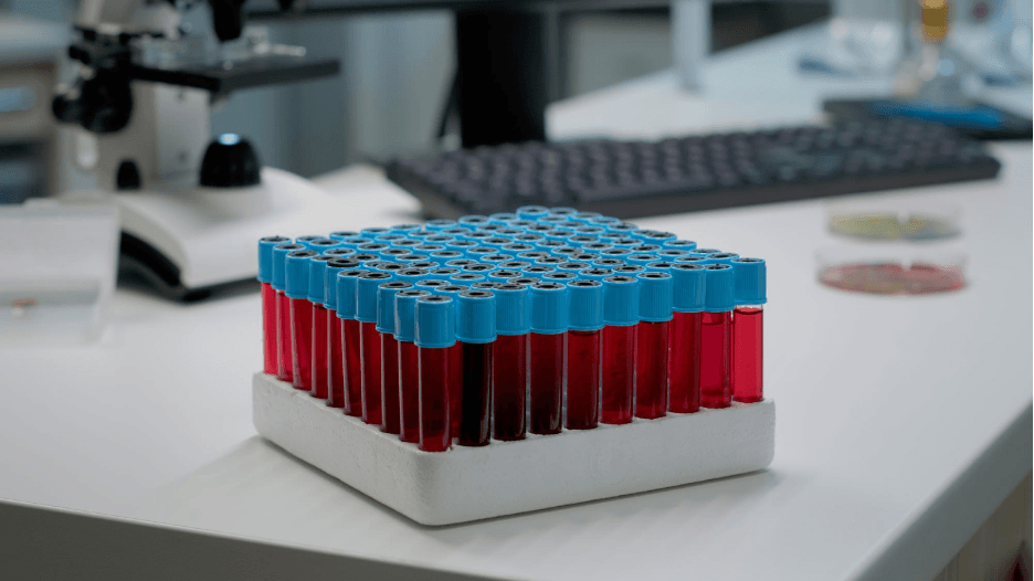 ELISA immunoassay kit