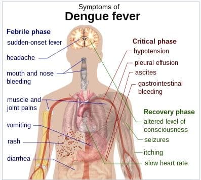 Schematic depiction of the symptoms of dengue fever