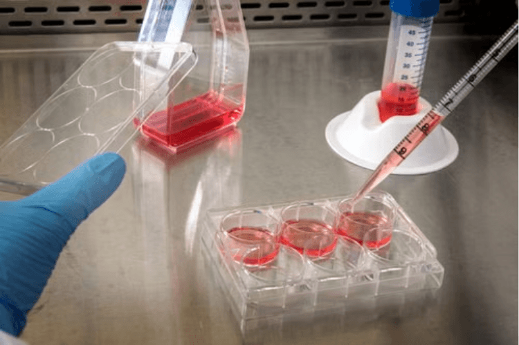 Causes of Cell Culture Contamination