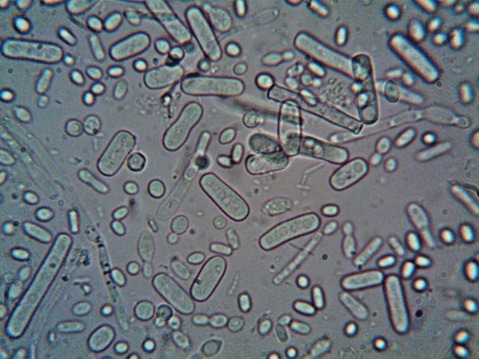 HaCaT Cell Culture Media and Conditions