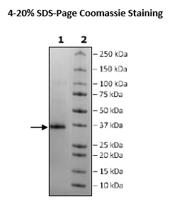 Spike RBD (B.1.351, Beta Variant) Avi-His-Tag (SARS-CoV-2) Recombinant