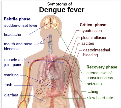 Schematic depiction of the symptoms of dengue fever