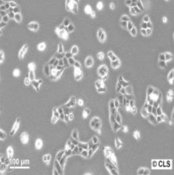 Microscopic picture of HaCaT cells growing in vitro. Using antibiotics will ensure no bacterial growth.