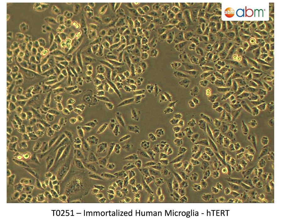 Microscope picture of immortalized human microglial cells