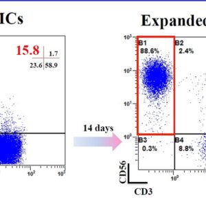 4 quadrant dot plot of CD3 vs CD56 showing NK cell expansion