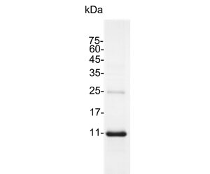 SDS Page Gel of Interleukin 4