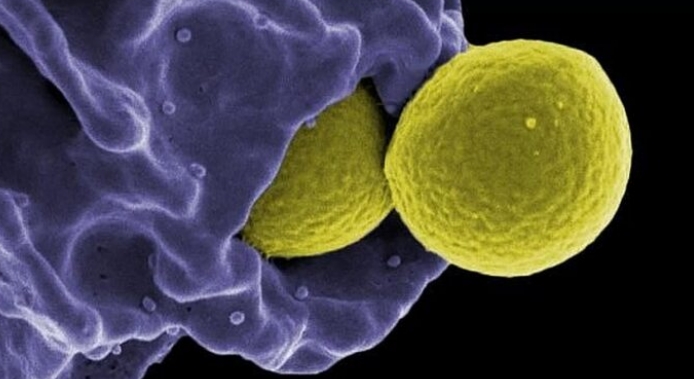 A microscopic image of a neutrophil cell engulfing a bacteria, illustrating the role of IL-8 in the immune response.