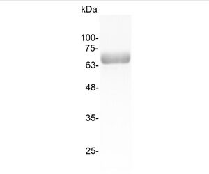 IL-12 p70 (Interleukin-12 p70), Human (mammalian cell expression)