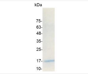 IL-17A (Interleukin-17A), Human