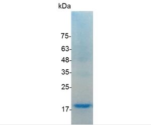 TNF alpha (Tumor necrosis factor α), Human
