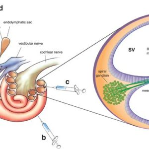 Schematic of inner ear