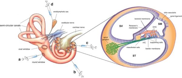Schematic of inner ear