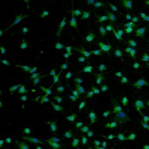 Normal Human Dermal Fibroblasts — Adult, Primary