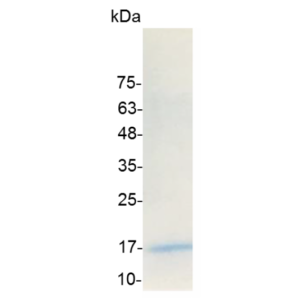 IL-17A (Interleukin-17A), Human