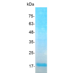 IL-23 p19 (Interleukin-23 p19), Human