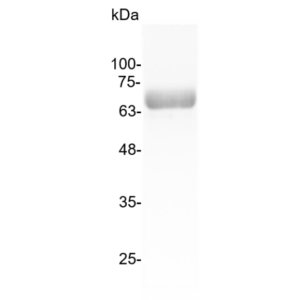 IL-12 p70 (Interleukin-12 p70), Human (mammalian cell expression)